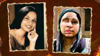 16 Years After Acid Attack, Shaheen Gets No Justice